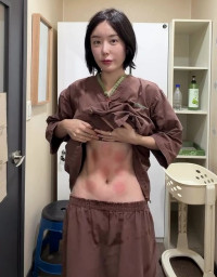 '딸셋맘' 이소라, 뭘 한 거지? 옷 들어올리자 선명한 복근 위 붉은자국 2시간 순삭